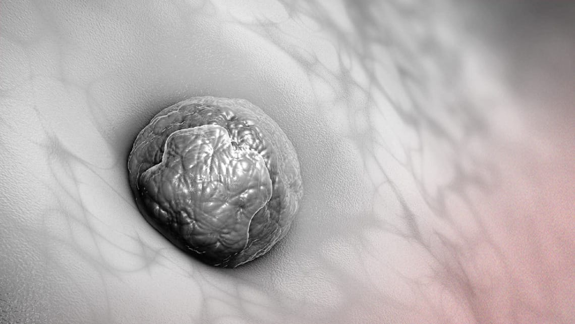 What Happens If an Embryo Transfer Fails?